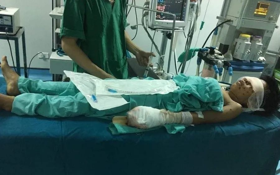 Một thiếu niên bị thương nặng sau tiếng nổ lớn