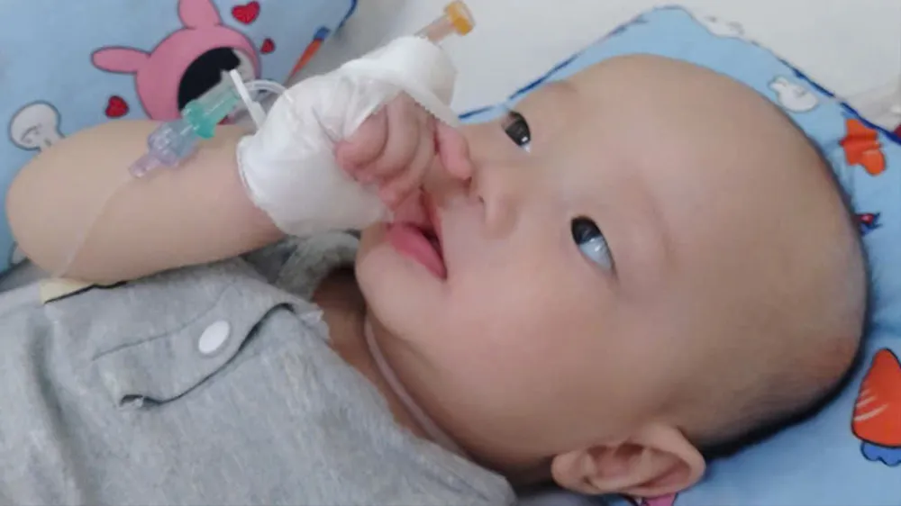Bé trai 6 tháng tuổi bị viêm tủy cột sống, nguy cơ bại liệt