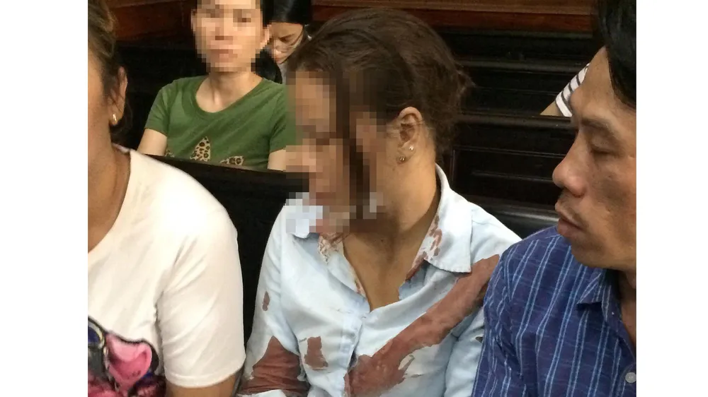 Chị Liền bị đánh chảy nhiều máu, được đưa đi cấp cứu và quay trở lại dự phiên tòa. Ảnh: MAI HOA