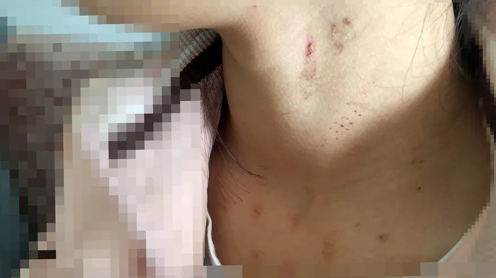 Công an truy tìm thủ phạm chặn xe, cưỡng hiếp nữ sinh lớp 10
