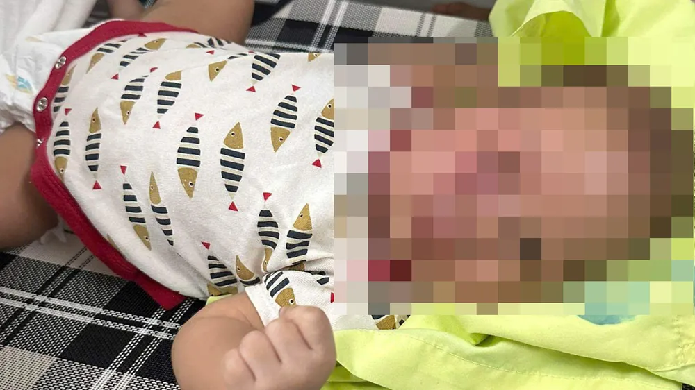 Công an vào cuộc vụ cháu bé 3 tháng tuổi bị đánh bầm tím mặt