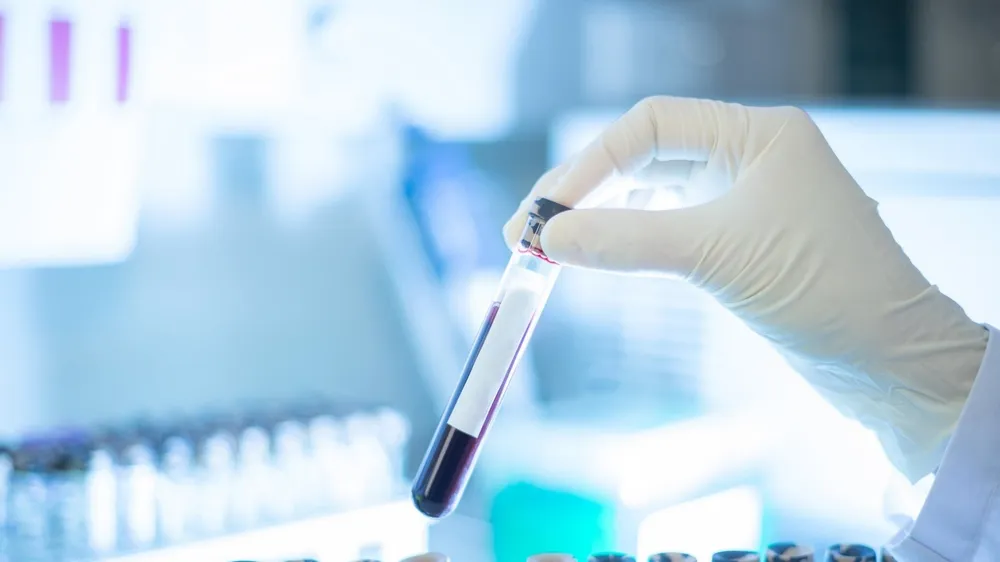 Xét nghiệm máu phát hiện sớm đa ung thư của Grail trên lộ trình xin được FDA cấp phép