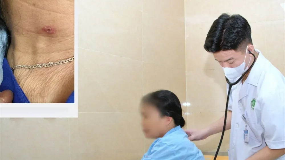 Vết loét nhỏ ở cổ giúp bác sĩ định hướng chẩn đoán sốt mò. Ảnh. BVCC