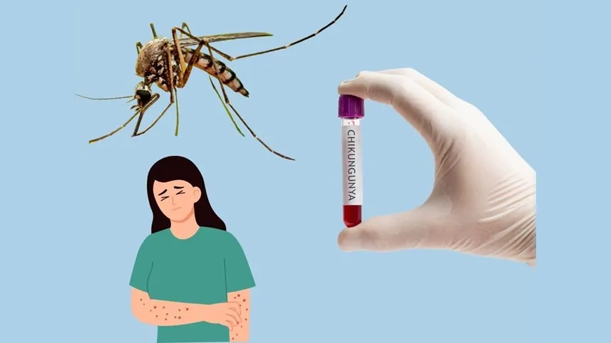 Triệu chứng bệnh Chikungunia xuất hiện sau 4-8 ngày từ khi muỗi Aedes nhiễm bệnh đốt