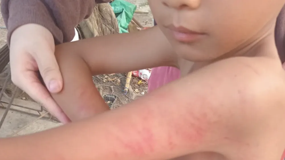 Đánh học sinh, cô giáo bị phụ huynh tát vào mặt