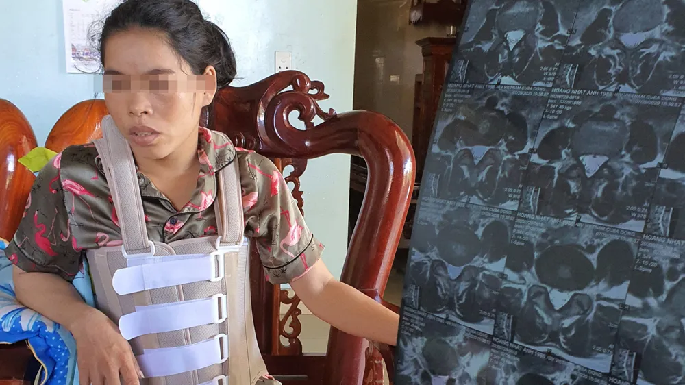 Khởi tố vụ một phụ nữ bị hành hung dã man suốt 11 năm
