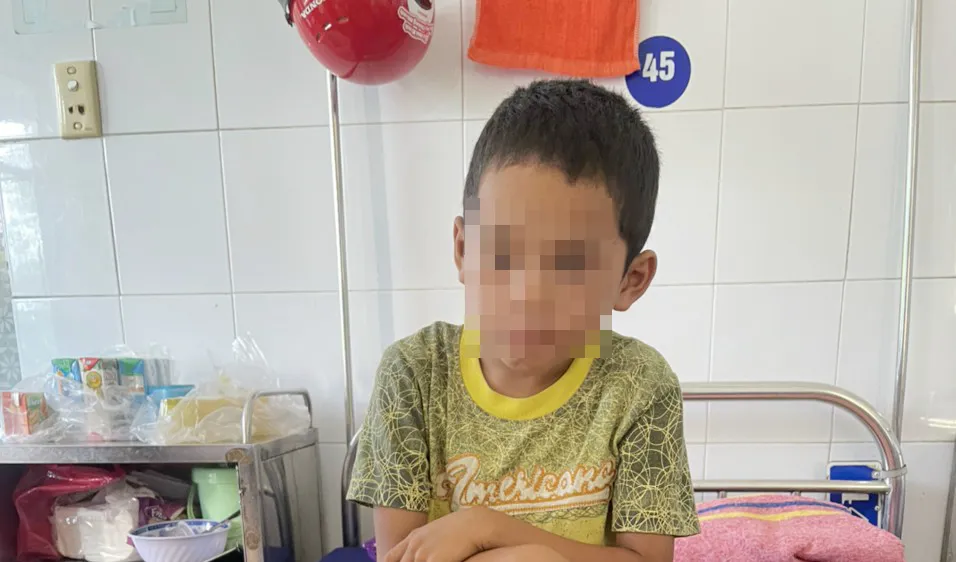 Cháu T. bi bỏng đang điều trị tại bệnh viện