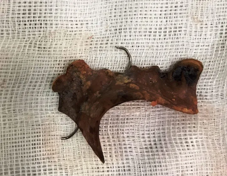 Vệ sinh cá nhân, nuốt hàm răng giả dài 4cm