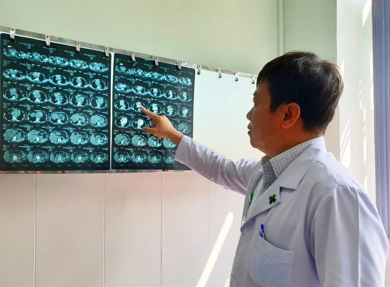 Phẫu thuật thành công bướu giáp thòng từ cổ xuống ngực