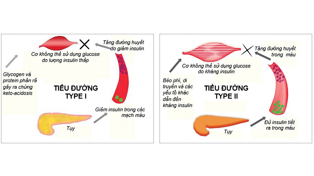 Thảo dược phục hồi tuyến tụy có hiệu quả không?
