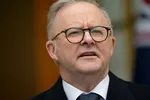 Thủ tướng Úc Anthony Albanese. (Ảnh: Getty)