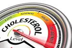Thừa cholesterol, tăng nguy cơ đột quỵ 
