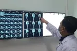 Bác sĩ kiểm tra kết quả chụp động mạch chủ của bệnh nhân