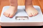 Đến năm 2030 cả nước sẽ có 2 triệu trẻ em thừa cân béo phì