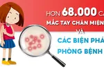 Hơn 68.000 ca mắc tay chân miệng và các pháp phòng bệnh