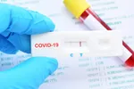 Xét nghiệm mới có thể phát hiện Covid-19 trước khi lây lan