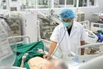 Bác sĩ Bệnh viện Bệnh Nhiệt đới Trung ương thăm khám cho bệnh nhân mắc cúm A. Ảnh: BVCC