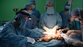 Conjoined twins sharing a liver separated after four-hour surgery