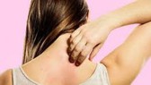 Bảo vệ sức khỏe trong mùa mưa