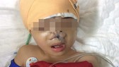 Bệnh nhân trước khi phẫu thuật