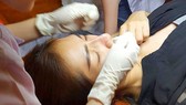 Cảnh báo biến chứng khi làm đẹp bằng phương pháp lột da