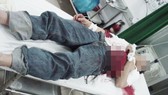 Anh trình báo em trai chết bất thường với nhiều thương tích