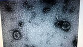 Hình ảnh virus Corona được phân lập, nuôi cấy thành công tại Viện Vệ sinh dịch tế Trung ương