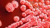Disease controller confirms two deaths caused by Whitmore’s Disease in Hanoi