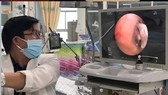 Bác sĩ đang nội soi gắp dị vật