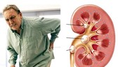 Đau mỏi ngang thắt lưng kèm tiểu đêm nhiều lần do thận hư, thận yếu phải làm sao?