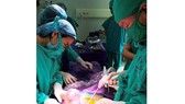Khối u buồng trứng kỳ quái mang hình thù bào thai 2 đầu