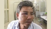 Khởi tố chủ quán cà phê Bố Già đánh trọng thương công nhân cây xanh