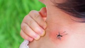 Số ca mắc sốt xuất huyết có xu hướng tăng