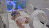 Bệnh nhi N.H.H đang được tích cực điều trị tại Bệnh viện Nhi đồng Đồng Nai