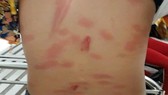 Khởi tố người cha nhẫn tâm hành hạ con ruột nhiều lần