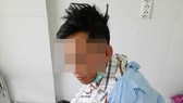 Anh Đỗ đang được điều trị tại bệnh viện