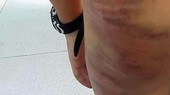 Cà Mau: Khởi tố vụ án mẹ kế đánh con riêng của chồng