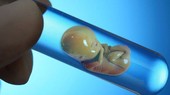 Surrogacy for commercial purposes more complicated