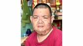 男青没有经费洗肾