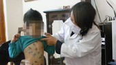 Bệnh Thủy đậu rất dễ lây lan thông qua đường hô hấp, tiếp xúc trực tiếp, dịch tiết mũi họng, dịch từ nốt phỏng thủy đậu