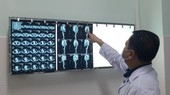 Bác sĩ kiểm tra kết quả chụp động mạch chủ của bệnh nhân
