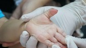 Shortage of intravenous fluids for the treatment of HFMD