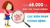 Hơn 68.000 ca mắc tay chân miệng và các pháp phòng bệnh