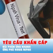 Podcast bản tin trưa 28-1: Bộ Y tế yêu cầu khẩn cấp củng cố các đội phản ứng nhanh ứng phó virus Nipah