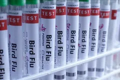 Hình ảnh minh họa ống xét nghiệm đựng mẫu bệnh phẩm virus cúm. Ảnh minh họa: TTXVN