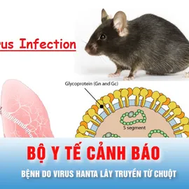 Podcast bản tin chiều 5-5: Bộ Y tế cảnh báo về bệnh do virus Hanta lây truyền từ chuột