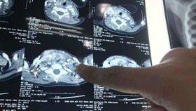 Scan of the toddler's tumor (Photo: SGGP)
