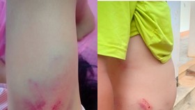 Làm rõ vụ Chánh văn phòng Huyện ủy đánh tài xế nhập viện