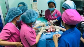 Sáng nay, gần 100 bác sĩ tham gia ca mổ tách ca song sinh dính liền phức tạp nhất Việt Nam