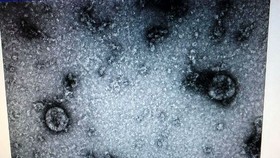 Hình ảnh virus Corona được phân lập, nuôi cấy thành công tại Viện Vệ sinh dịch tế Trung ương